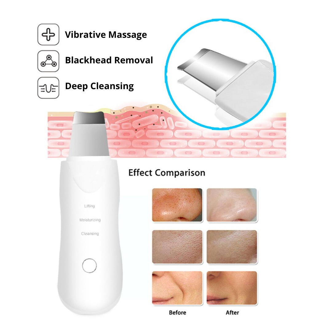 3 in 1 Ultrasonic Skin Scrubber - Deep Cleanser