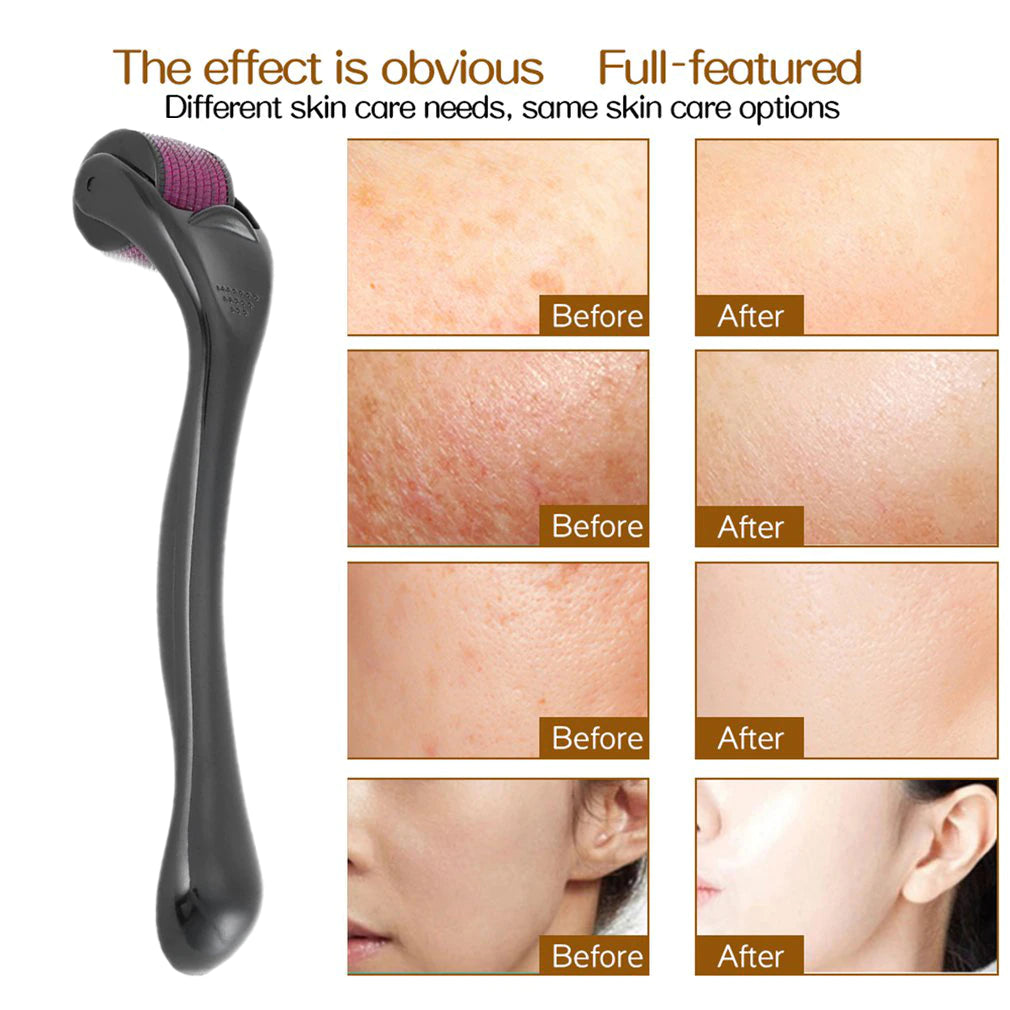 Derma Roller Titanium Needle 0.5 mm - Hair Growth & Skin Treatment